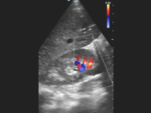 GE HealthCare's Vscan Air ultrasound