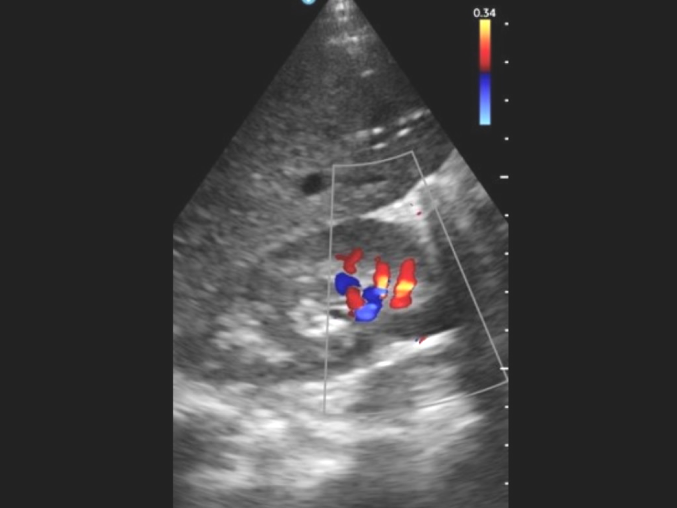 GE HealthCare's Vscan Air ultrasound