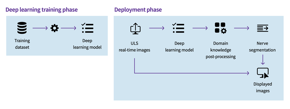 A diagram of how AI enables cNerve to assist in ultrasound-guided nerve blocks.
