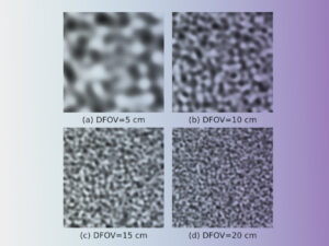 Four medical images showing different DFOV settings at 5 cm, 10 cm, 15 cm, and 20 cm