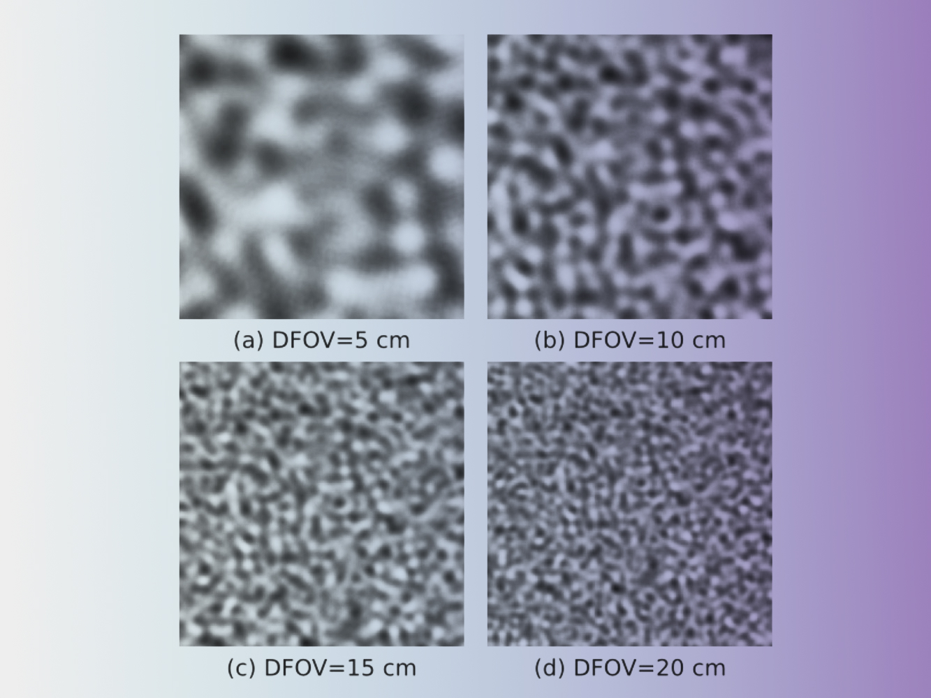 Four medical images showing different DFOV settings at 5 cm, 10 cm, 15 cm, and 20 cm