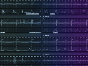 An image showing a dashboard for CareIntellect for Perinatal