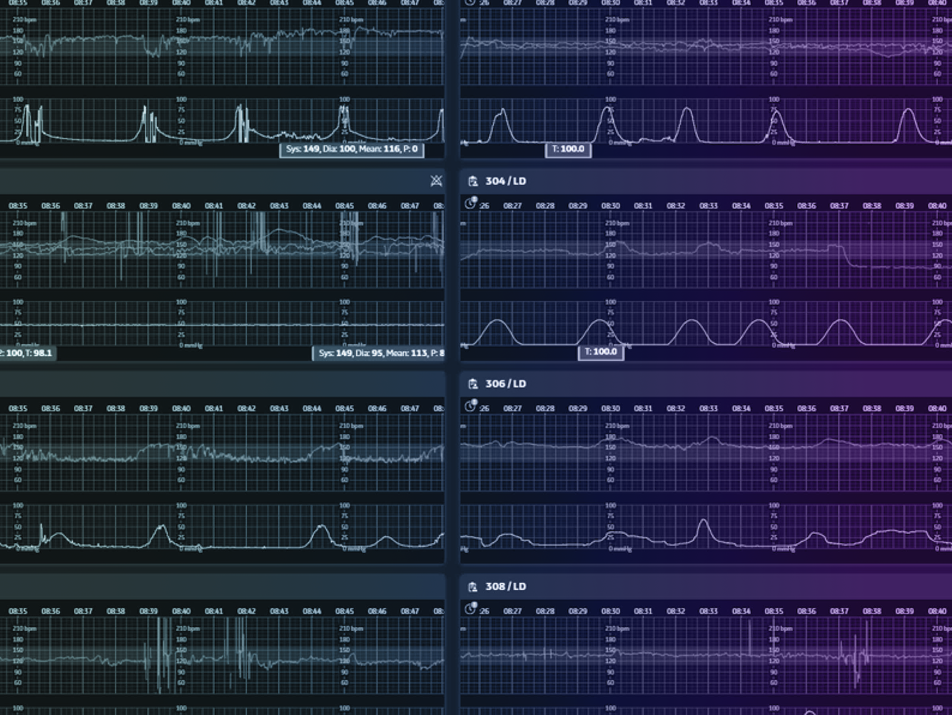 An image showing a dashboard for CareIntellect for Perinatal