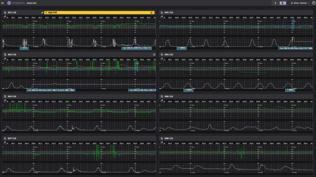 An image showing a dashboard for CareIntellect for Perinatal