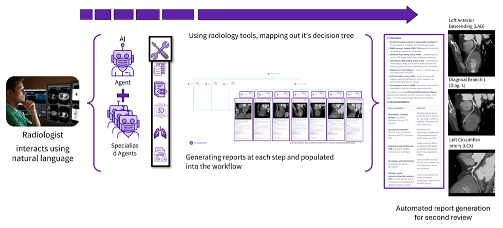 Reinventing radiology imaging workflows with agentic AI
