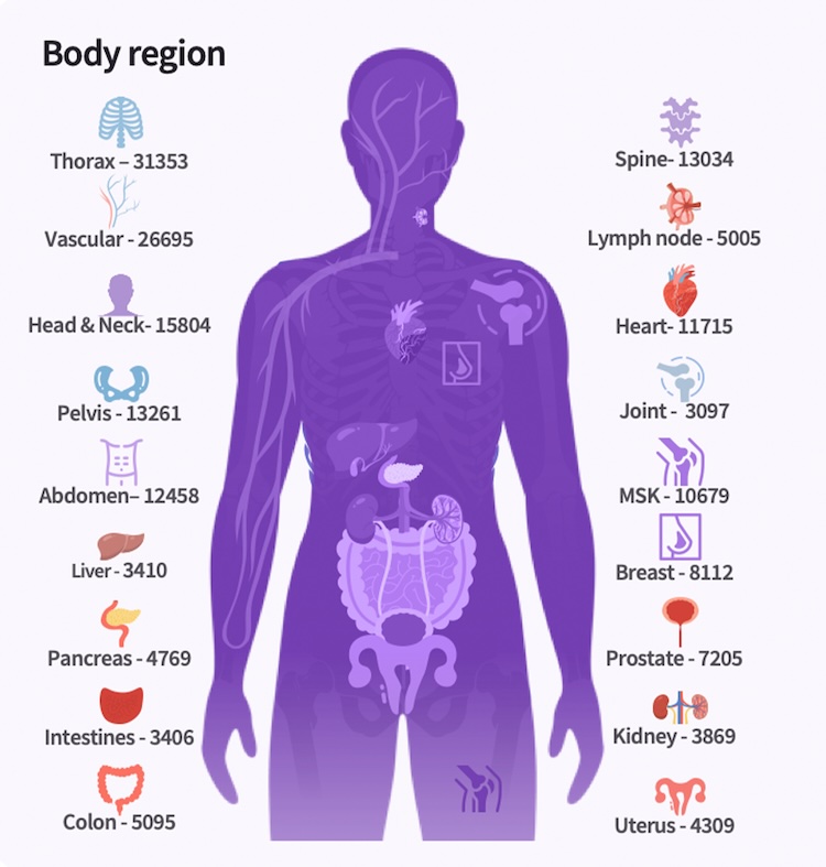 GE HealthCare’s model is one of the early large-scale, full-body and multi-sequence 3D MR foundation models (MR FM)