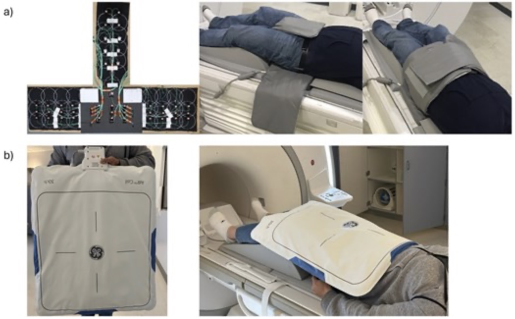 Improved prostate diffusion imaging using deep learning denoising and phase correction with ultra-high-density coil array
