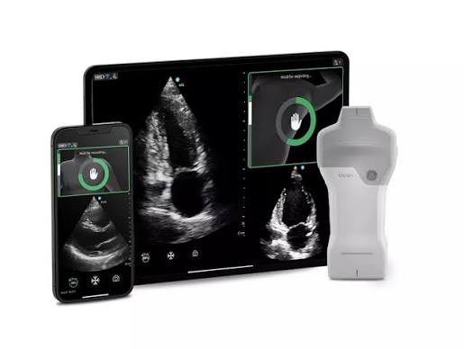 How an AI algorithm that mirrors the human eye expands access to cardiac care